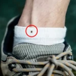 permetrina nos sapatos